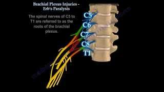 Brachial Plexus Injuries Erbs Paralysis  Everything You Need To Know  Dr Nabil Ebraheim [upl. by Monsour]