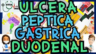 ÚLCERA PÉPTICA GÁSTRICA Y DUODENAL  GuiaMed [upl. by Mckenzie]