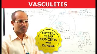 Vasculitis  Causes Symptoms amp Treatment [upl. by Elvera]