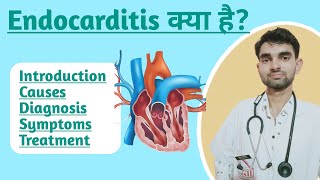 Endocarditis in Hindi  Causes Symptoms  Diagnosis and Treatment of Endocarditis [upl. by Talbot]