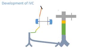 Inferior vena cava development [upl. by Deborah]