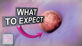 Embryo Transfer Day Behind the Scenes What to Expect [upl. by Schrick]