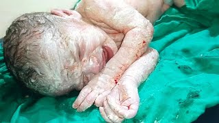 Cute and adorable newborn baby girl with vernix caseosa just born video 37weekspregnant babygirl [upl. by Annayhs]