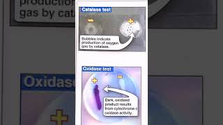 Catalase and oxidase test [upl. by Nwahsyar]