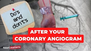 Post your coronary angiogram  What to know [upl. by Darken195]