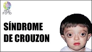 SÍNDROME DE CROUZON  Red Fono [upl. by Bromleigh]