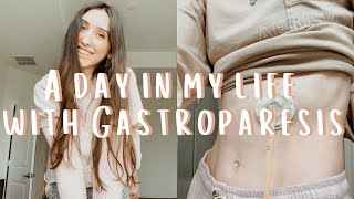 a day in my life with gastroparesis and a GJ feeding tube [upl. by Attenal]