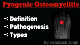 OSTEOMYELITIS Pathology [upl. by Yltnerb968]