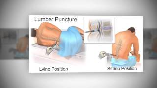 Lumbar Puncture LP [upl. by Drew]