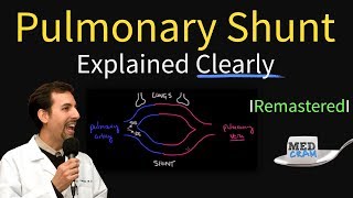 Shunting Explained Clearly Pulmonary Shunt  Remastered [upl. by Editha]