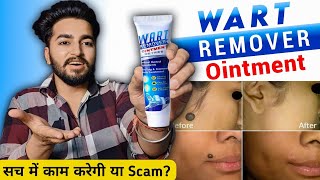 Wart Remover Cream Review  Wart Remover Ointment [upl. by Caldeira]