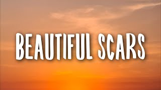 Maximillian  Beautiful Scars Lyrics [upl. by Claudette]