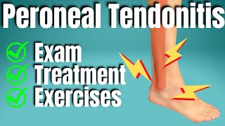 Peroneal Tendonitis Treatment  San Diego Sports Chiropractic [upl. by Isbella]