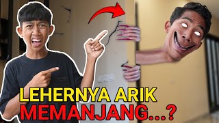 ARIK LEHERNYA GAK BISA BERHENTI TUMBUH MEMANJANG😱 KOK BISA Toollloonggg  Mikael TubeHD [upl. by Yk427]