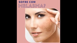 Melasma Antes  Melasma depois [upl. by Evars]