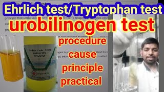 Urobilinogen test ll Ehrlich test ll Tryptophan test in urine practical [upl. by Hannavas107]