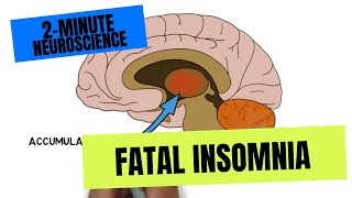 2Minute Neuroscience Fatal Insomnia [upl. by Enialed]