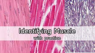 Identifying Muscle  Review and Practice [upl. by Renell]