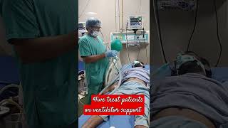 live treat patients on ventilator support ajeet Singh medical ki duniya short [upl. by Htiffirg]