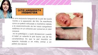 Neonatología y lactancia materna  Hallazgos normales y Anormales en la piel de un recién nacido [upl. by Crescen]