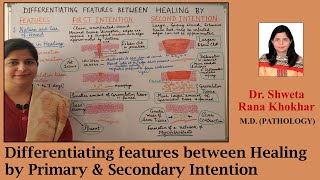 Differentiating features between Healing by Primary amp Secondary Intention [upl. by Elyrad]