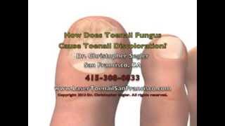 How Does Toenail Fungus Cause Toenail Discoloration [upl. by Andrej728]