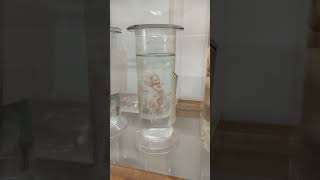 Preserved Foetuses and Placenta  Museum specimens [upl. by Ingles95]