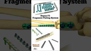 Depuy F3 Fragment Plating System medical animation 3d short Biology with Aliya [upl. by Vashti]