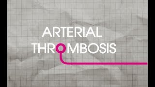 Arterial Thrombosis Explained [upl. by Lieno]