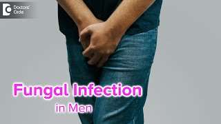 Fungal infection in Men Causes amp Treatment  Yeast Infection in Men Dr Nischal KDoctors Circle [upl. by Halludba]