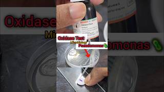 Oxidase Test 🧫🧪🔬🦠 Biochemicaltest  Microbiology Lab  Basics biochemistry shorts microbiology [upl. by Nyar]