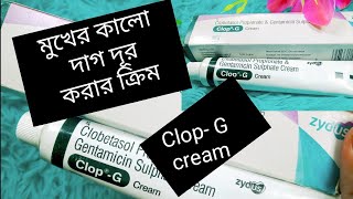 Clop G cream এর ব্যবহার মুখের কালো দাগ দূর করার ক্রিম tok forsa houyar cream clop G [upl. by Arytahs486]