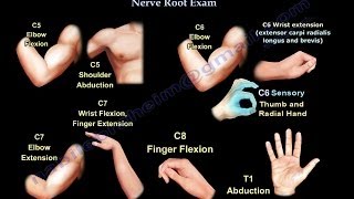 Cervical Spine Nerve Root Exam  Everything You Need To Know  Dr Nabil Ebraheim [upl. by Merrel]