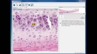 Module 2 Hyaline Cartilage [upl. by Lucias]