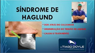 SÃ­ndrome de Haglund  o que Ã© como diagnosticar e tratamento [upl. by Idnod]