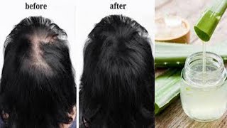 Us Aloe Vera water turn breaking hair to thick dark hair in 30 days [upl. by Alyar]