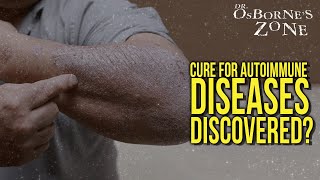 Cure for autoimmune diseases discovered  Dr Osbornes Zone [upl. by Gnurt]