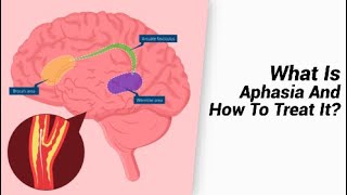 What Is Aphasia And How To Treat It [upl. by Crowns183]