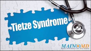 Tietze Syndrome ¦ Treatment and Symptoms [upl. by Eerak]