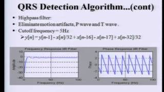 ECG Analysis 1 QRS Detection [upl. by Annelise]