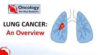 Lung Cancer An Overview [upl. by Nnylf]