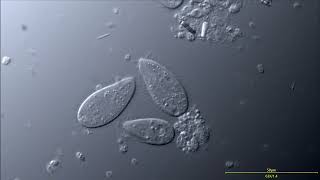 Small Marine Ciliates ciliophora  Structure cilia macronucleus vacuoles DIC microscopy 4K [upl. by Waldos]