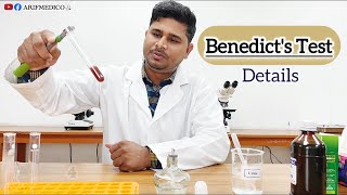 Benedicts Test  PrincipleProcedure and result  Benedicts Bangla benedicttest [upl. by Rivkah]