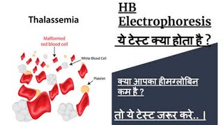 Hb electrophoresis by HPLC Method  Hemoglobin electrophoresis [upl. by Ayoras]