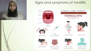 Tonsillitis cause symptoms and treatment Dr Salman Pabbi tonsillitis whats tonsillitis Urduhindi [upl. by Ahseiyt]