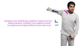 013 Subclavius muscle stretching exercise [upl. by Nordin581]