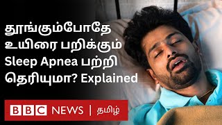 உஷார் உயிரையே பறிக்கும் குறட்டை இந்த அறிகுறி வந்த Alert ஆயிடுங்க  Sleep Apnea [upl. by Aissyla]