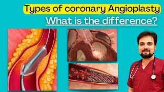 Types of Coronary Angioplasty  Whats the Difference [upl. by Lamrert]