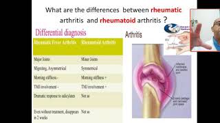 what are the differences between rheumatic fever arthritis and rheumatoid arthritis migratory [upl. by Nivlam]