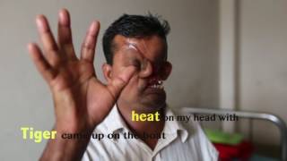 Fisherman whose face was destroyed by a Tiger in Sundarban [upl. by Mloc]